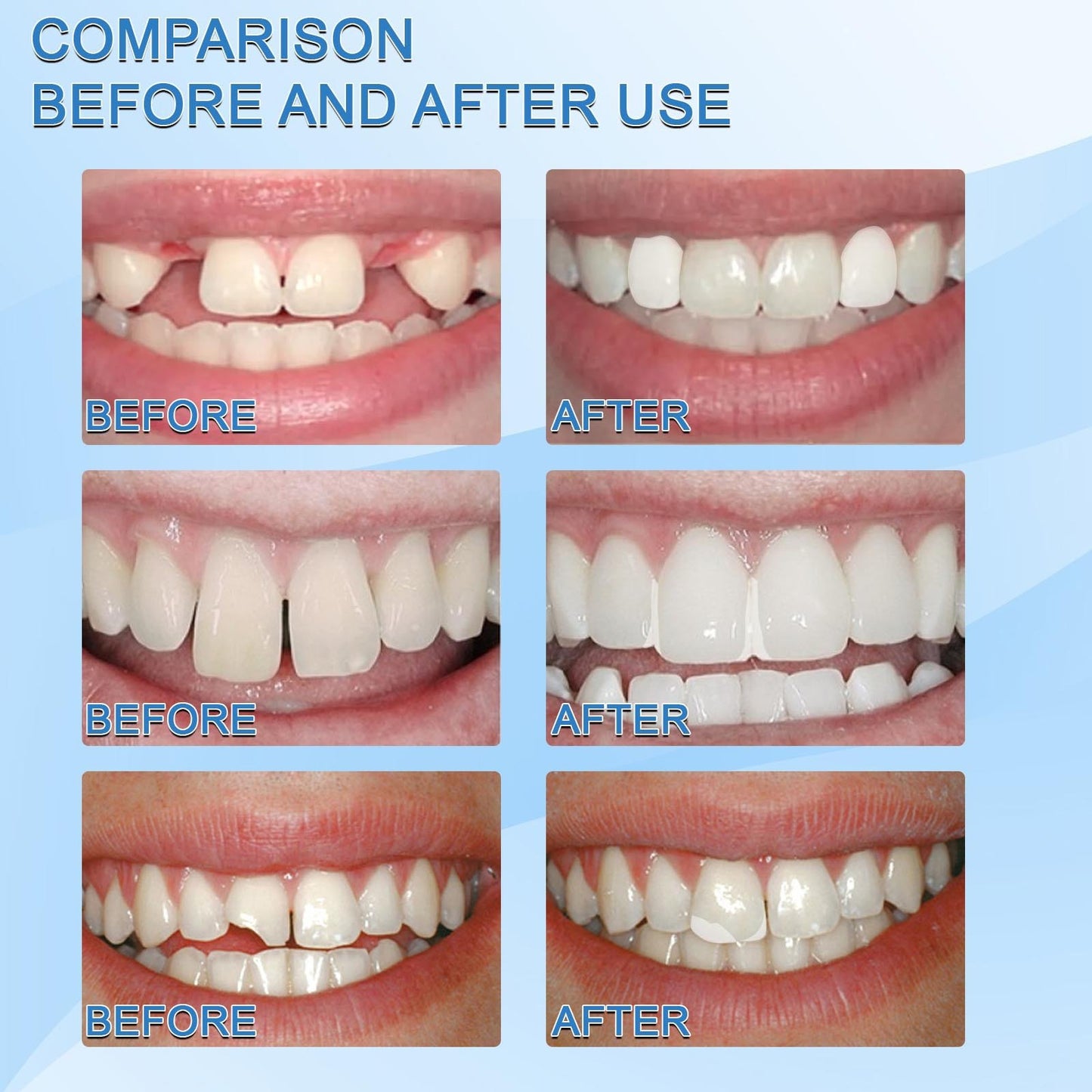 Temporary Repair Tooth